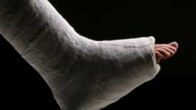 zdroj: rugbyrescue.com