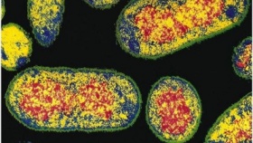 zdroj: archiv Metropolu