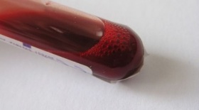 zdroj: archiv Metropolu