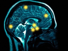 zdroj: archiv Metropolu