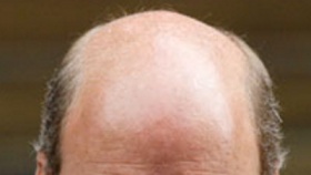 zdroj: archiv Metropolu