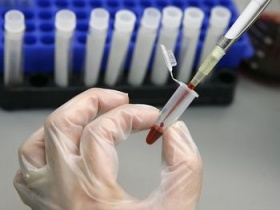 zdroj: archiv Metropolu