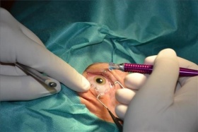 Kliknutím zvětšíte obrázek