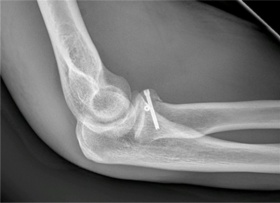 Kliknutím zvětšíte obrázek