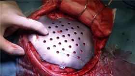 Kliknutím zvětšíte obrázek