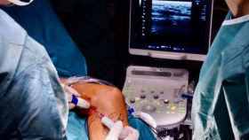 Lidé s křečovými žilami v létě trpí, mohou podstoupit šetrný zákrok