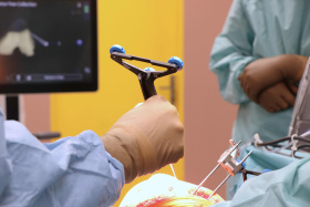 Ústecká Masarykova nemocnice nasadila dalšího robota, tentokrát pro kloubní náhrady