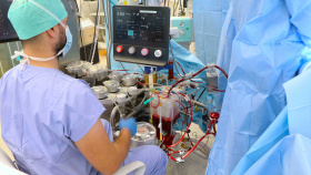 Masarykova nemocnice má nejmodernější přístroj pro mimotělní oběh při operacích  na nebijícím srdci