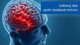 Světový den mrtvice připomenou akce pro veřejnost v OC v Mostě a Teplicích